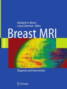 Breast MRI - Laura Liberman