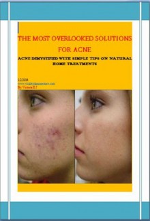 THE MOST OVERLOOKED SOLUTIONS FOR ACNE - Victoria Johnson