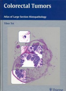 Colorectal Tumors: Atlas of Large Section Histopathology - Tibor Tot