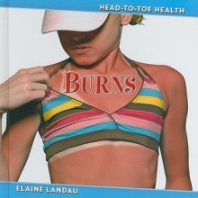 Burns - Elaine Landau, Joy Bean