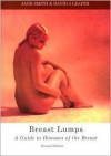 Breast Lumps: A Guide to Diseases of the Breast - Jane Smith