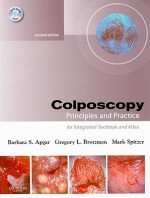 Colposcopy: Principles and Practice; An Integrated Textbook and Atlas [With Dvdrom] - Barbara S. Apgar, Mark Spitzer, Gregory L. Brotzman