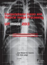 Computational Vision and Medical Image Processing IV: Vipimage 2013 - Joao Manuel RS Tavares, Jorge R M Natal